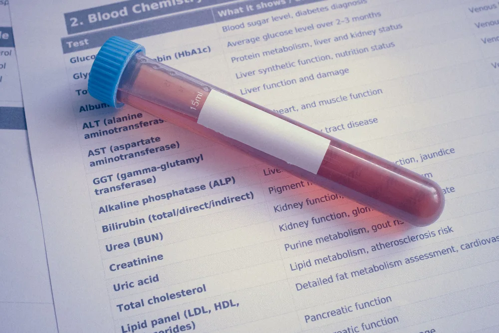 A capped blood sample tube resting on a printed laboratory test request form listing blood chemistry tests.