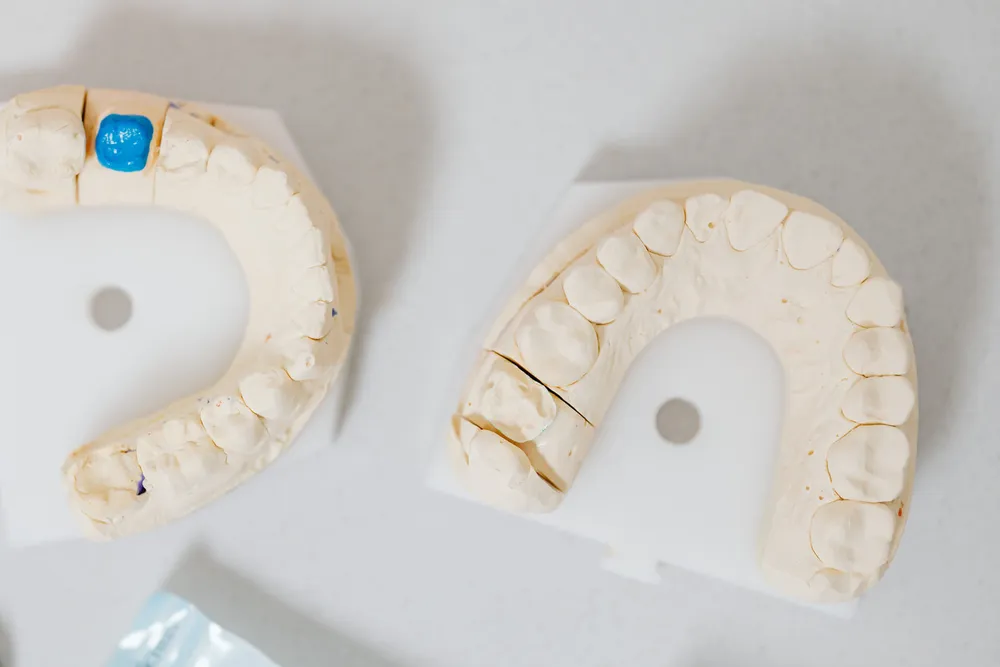 Plaster casts of an upper and lower set of teeth resting on a pale surface in a dental workroom.